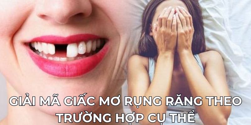 Giải mã giấc mơ rụng răng theo trường hợp cụ thể